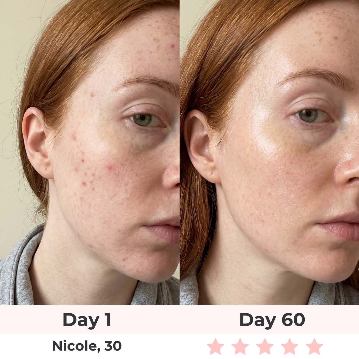 Lux Cove Anti-Aging Vitamin C Serum