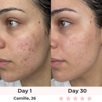 Lux Cove Skin Firming 5-in-1 Hyaluronic Acid Face Serum