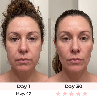 Lux Cove 7-in-1 LED Facial Sculptor